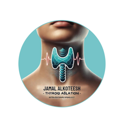 thyroidablaionuae