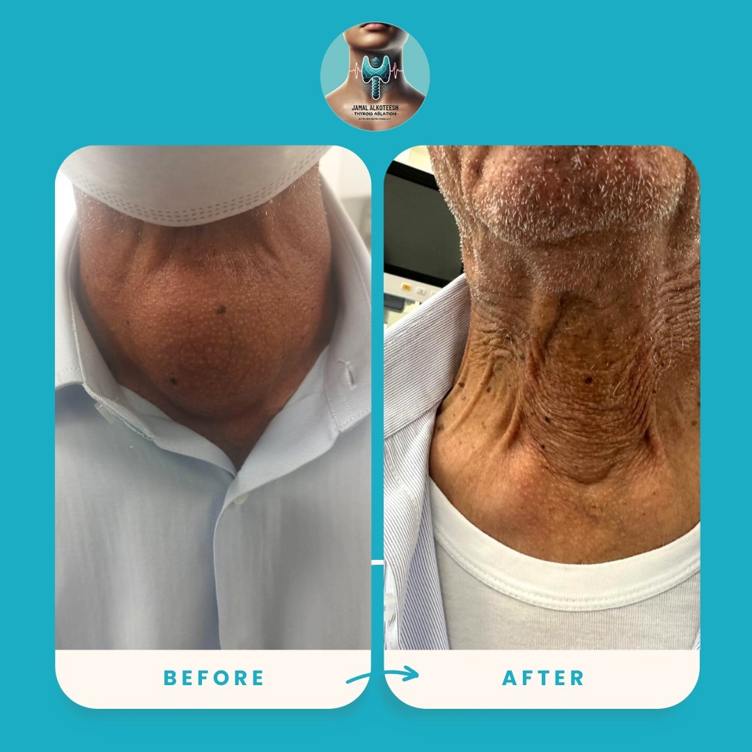 Before And After <br> <br>